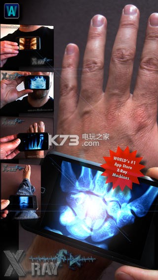 手机扫描骨骼软件下载v2.9 手机扫描骨骼app下