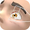 眼科医生 v0.2 安卓版