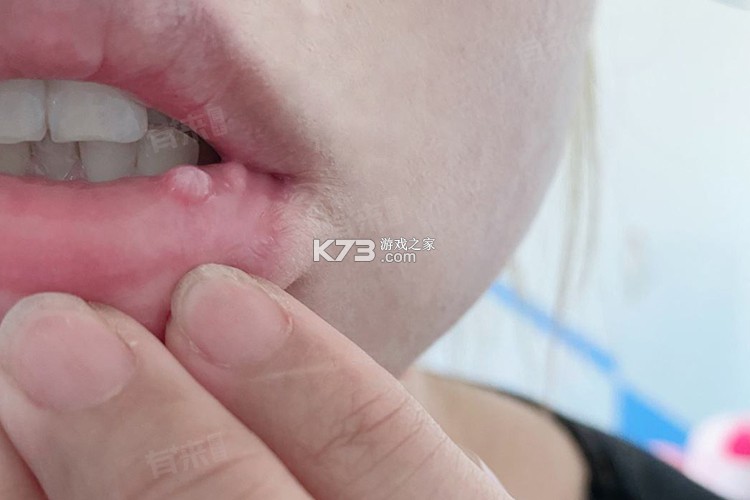 起嘴泡 v2.7.6 下载免费 截图