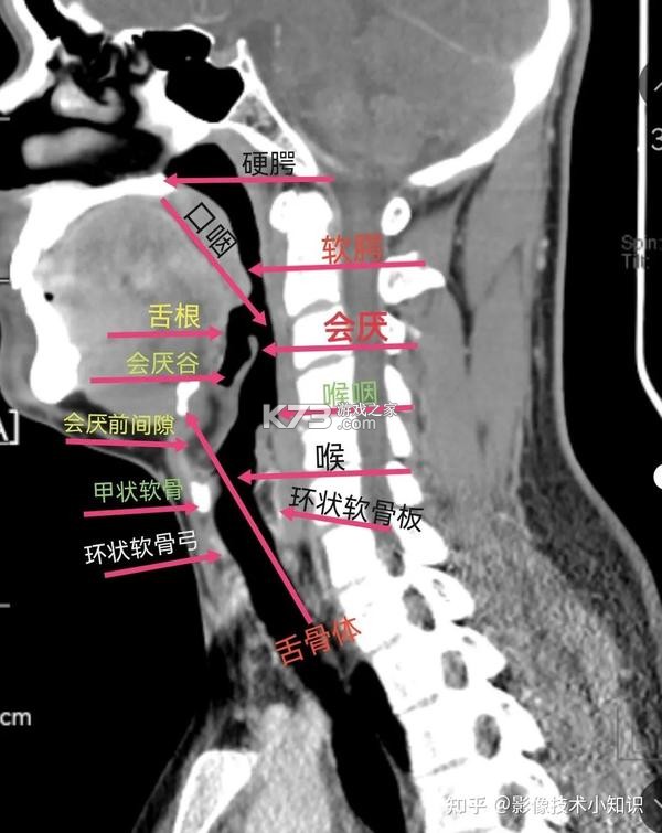 火火电体育星球 v1.1.0 app下载 截图