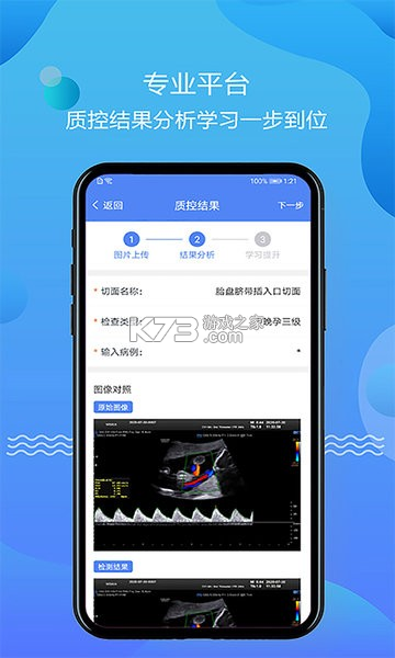 超声智学 v2.2.0 app下载免费 截图